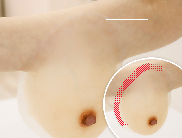 オーダーメイドの人工乳房だから、乳がん術後の温泉も安心